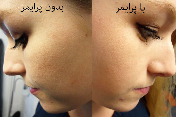 پرایمر ضد جوش و ضد قرمزی فلورمار Anti - blemish | سبز