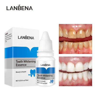 سفید کننده دندان لانبنا lanbena teeth whitening