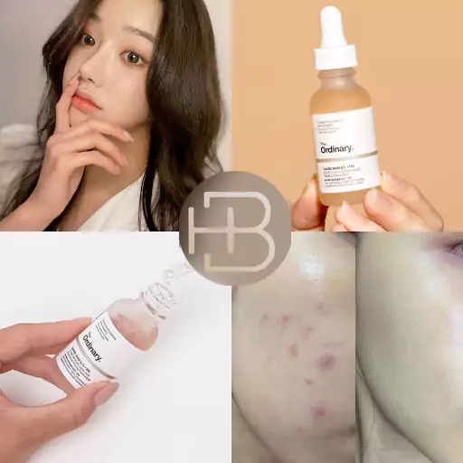 تاثیرات سرم لاکتیک اسید