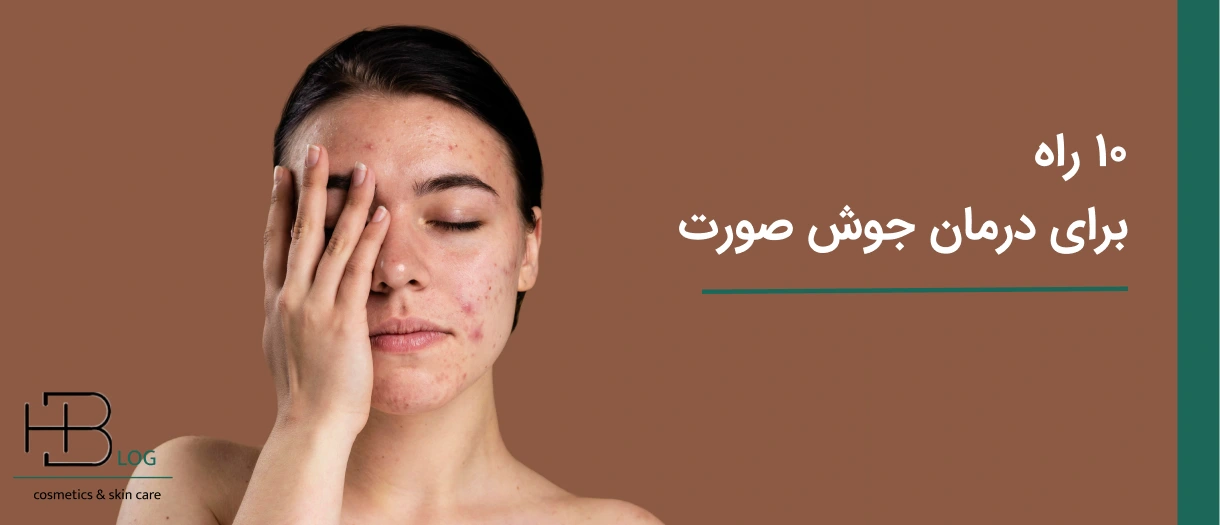 ۱۰ راه بی نظیر برای درمان جوش صورت