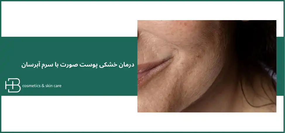 درمان خشکی پوست با آبرسان