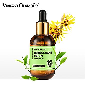 سرم ضدجوش چای سبز ویبرانت گلامور Vibrant Glamour