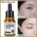 سرم ضدلک آربوتین و روشن کننده ویبرانت گلامور  ARBUTIN WHITENING SERUM