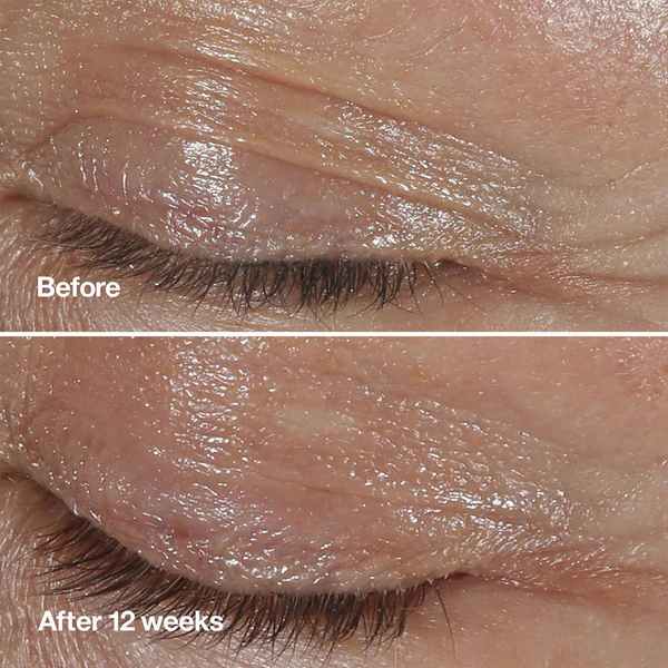 کرم دور چشم ضد چروک اسمارت کلینیک مدل Clinical Repair